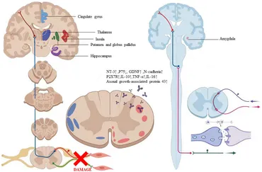 健康・医学 Nerve Injury and Repair 2nd edition C13006_r_brach_plex_neuroma_gr