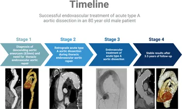洋書 Surgical and Endovascular Treatment of A 51n6eHcV19L._UF350,350_QL50_.jpg