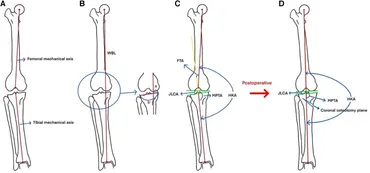 大腿骨近位部骨折 Osteosynthesis & Arthroplasty 下肢の骨折手術① 骨盤・大腿骨［Web動画付］ (新OS NEXUS No.4