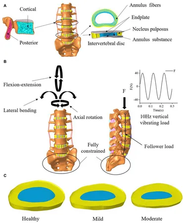 脊椎脊髄病学 = PRINCIPLES OF SPINAL DISORDERS Spinal Disorders: Fundamentals of Diagnosis and Treatment