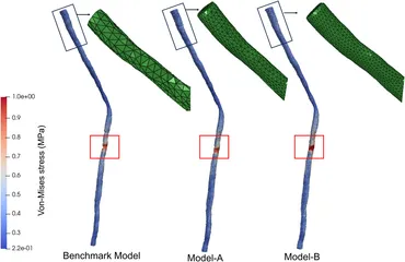 Frontiers | Biomechanical analysis of spinal cord injury