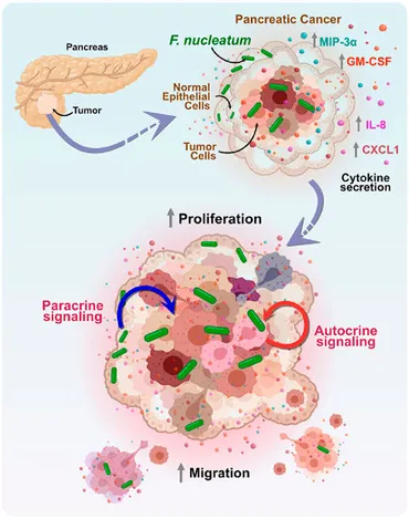 Frontiers | Insights and therapeutic advances in pancreatic Frontiers | Insights and therapeutic advances in pancreatic