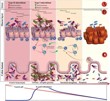 Frontiers | Effect of Helicobacter pylori–induced gastric