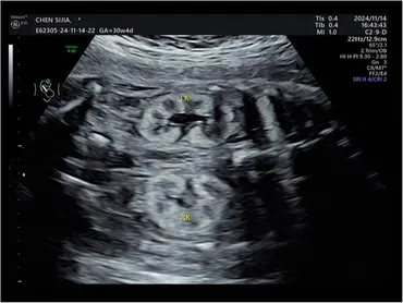 Ｎ シングルス あん Offspring x adidas ZX 8000