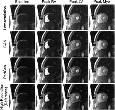 Whole Process of Standardization of Diffusion-Weighted