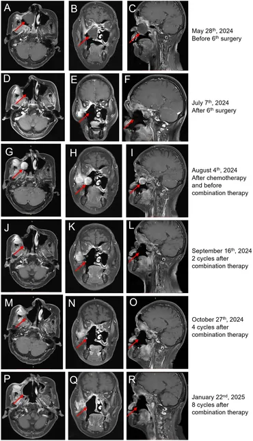 MRI and CT Atlas of Correlative Imaging in Otolaryngology Flanders， Adam E、 Rao， Vijay M; Tom， Barry M MRI and CT Atlas of Correlative Imaging in Otolaryngology