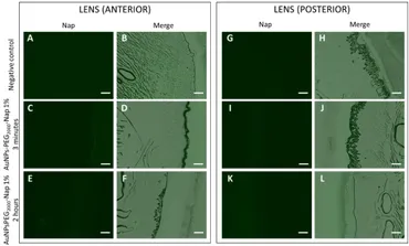 Frontiers | Localization of fluorescent gold nanoparticles Frontiers | Localization of fluorescent gold nanoparticles