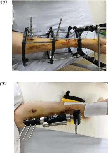 Frontiers | Case Report: Effect of transcutaneous auricular vagus