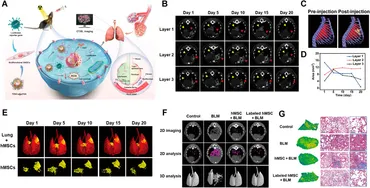 Frontiers | Ferroptosis in pulmonary fibrosis: pathogenesis