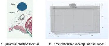 Frontiers | Pulsed electric field ablation process—a study