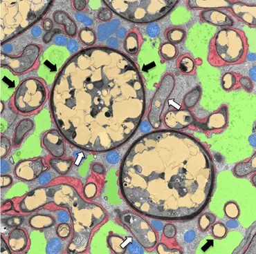 Frontiers | How membranes shape plant symbioses: signaling Frontiers | How membranes shape plant symbioses: signaling