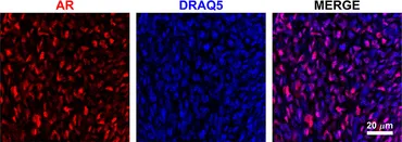 Frontiers | Regional Variation in Androgen Receptor