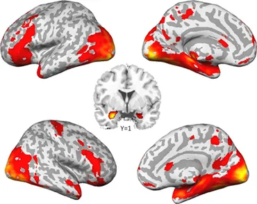 平井 Synaptic pruning through glial synapse engulfment upon motor