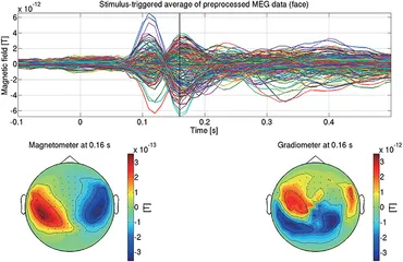 Frontiers | MEG Source Imaging and Group Analysis Using VBMEG