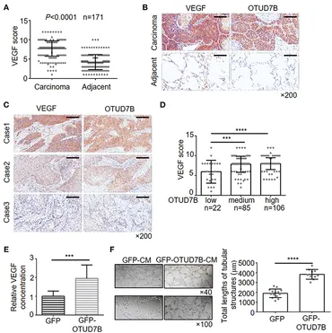 Frontiers | Upregulation of OTUD7B (Cezanne) Promotes Tumor Frontiers | Upregulation of OTUD7B (Cezanne) Promotes Tumor
