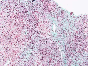 Frontiers | Novel Diagnostic and Therapeutic Strategies in