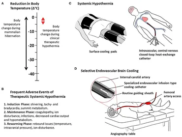 Hypothermia for Acute Brain Damage: Pathomechanism and Practical Aspects [ハードカバー] Hayashi， N.? Bullock， R.? Dietrich， D.W.? Maekawa， T.; Tamura， A. fneur-11-594289-g001.jpg