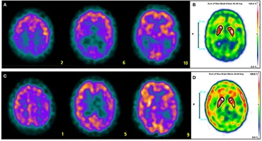 【美品・電子版使用済】Diagnostic Imaging: Brain 脳画像 Diagnostic Imaging: Brain, 4th ed.: 洋書／南江堂