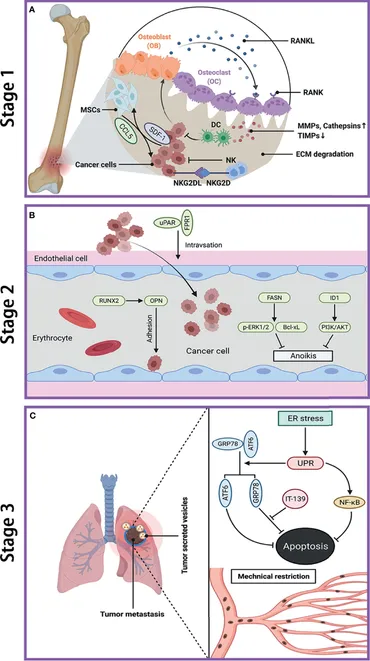 Frontiers | Osteosarcoma and Metastasis
