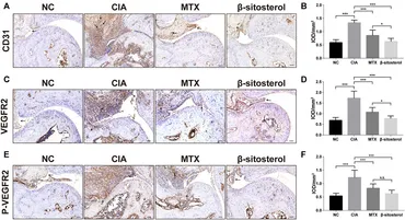 Diallyl Disulfide Induces Chemosensitization to Sorafenib
