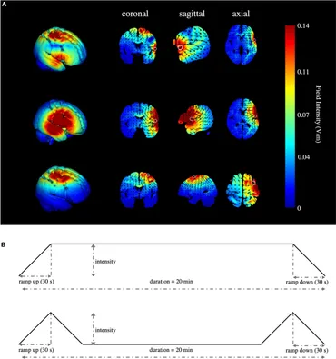 Frontiers | Multitarget high-definition transcranial direct