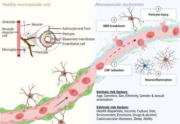 Decision Making in Neurovascular Disease: jetzt bestellen im