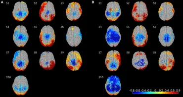 Frontiers | EEG beta suppression and low gamma modulation