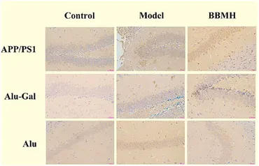 Frontiers | Prominent Effects of Berbamine Hydrochloride on