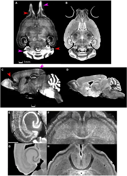Cranial Magnetic Resonance Imaging 医学書 洋書』 古書・古文書