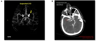 ENCYCLOPAEDIA of OCCLUSION【裁断済】 Individualized gray matter morphological abnormalities