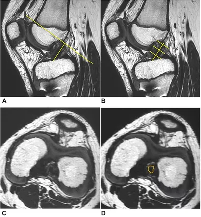 健康・医学 MRI ARTHROSCOPY and SURGICAL ANATOMY Mri, Arthroscopy, and Surgical Anatomy of the Joints