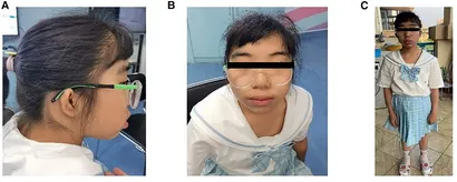 内科診断学 = MEDICAL DIAGNOSIS Z01.818 – Encounter for other preprocedural examination