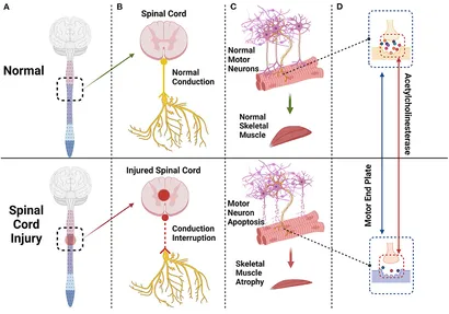 Frontiers | Mechanism of skeletal muscle atrophy after spinal cord