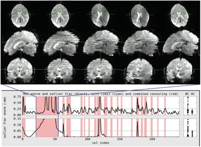 fMRI 原理と実践 fMRI | 福山秀直 |本 | 通販 | Amazon