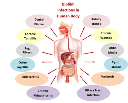 Endometriosis, Pain, and Related Psychological Disorders