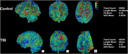 Amazon.co.jp: Diffusion Tensor Imaging: A Practical Handbook