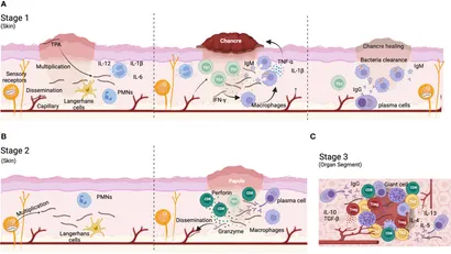 Frontiers | Syphilis vaccine: challenges, controversies and