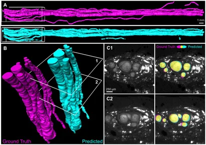 BRAIN AND NERVE2021年11月号 In Vivo Detection of Neurofibrillary Tangles by 18F-MK-6240