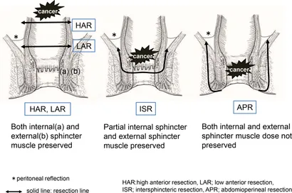 Frontiers | Comparison of long-term quality of life based on
