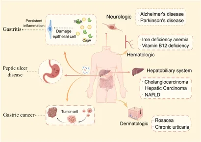 Frontiers | Helicobacter pylori infection: a dynamic process