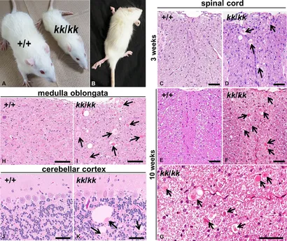 MEDULLA　叶 Stria medullaris innervation follows the transcriptomic