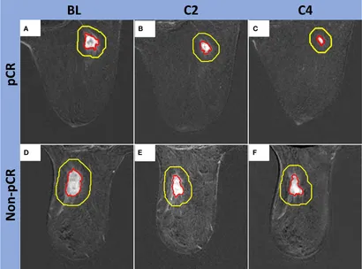 Frontiers | Longitudinal dynamic contrast-enhanced MRI