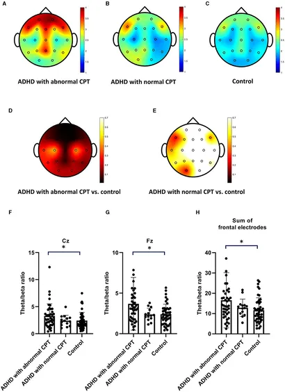 0.315 E VS-2 3EX HC Faint CGL アカデミー EHA 2025: CYCLOPHOSPHAMIDE IS SUPERIOR TO METHOTREXATE IN