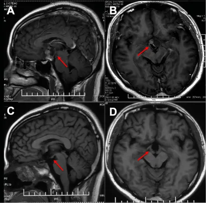 小児神経の画像診断 = Diagnostic Imaging of Infan…