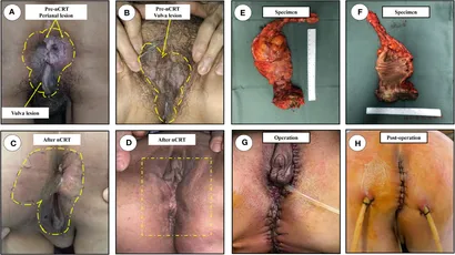 Ginekolog tomonidan anal klizma