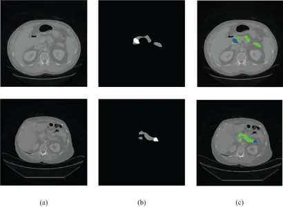 myn様 ミニYパッキン MYA・MYN・MYH - 阪上製作所