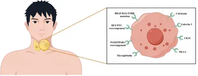 Thyroid Cancer: 9783540223092: Medicine & Health Science