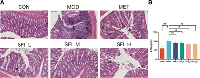 【超目玉枠】 Shenfu | Frontiers injection isoproterenol-induced improves ダーツ