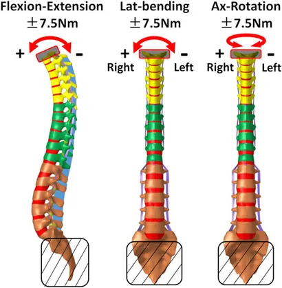 脊椎脊髄病学 = PRINCIPLES OF SPINAL DISORDERS Spinal disease - Wikipedia
