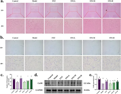 Ｍ ER stress in mouse serotonin neurons triggers a depressive
